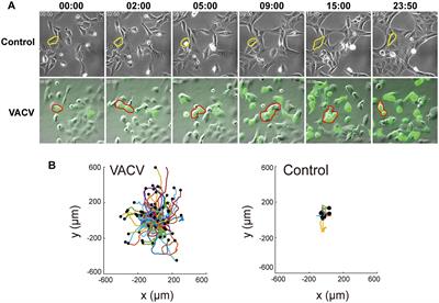 Temporal proteomic profiling reveals functional pathways in vaccinia virus-induced cell migration